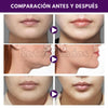 TIRAS LIFTING FACIAL 120 PIEZAS