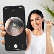 LIMPIADOR DE OÍDO CON CAMARA HD