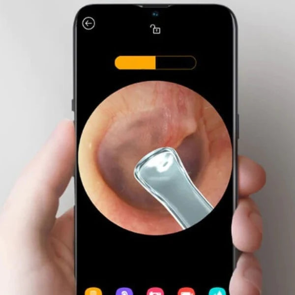 LIMPIADOR DE OÍDO CON CAMARA HD