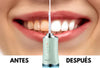 IRRIGADOR DENTAL
